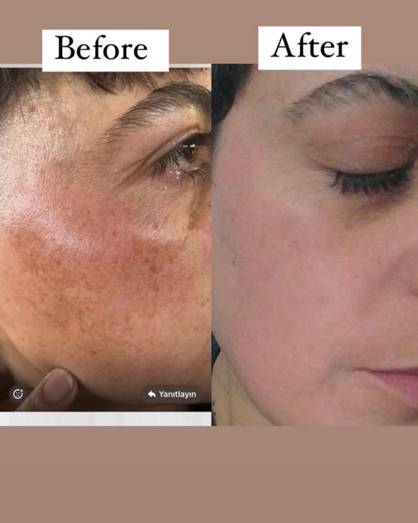 MÜŞTERİLERİMİZDEN KARELER